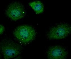 Invitrogen USP13 Polyclonal Antibody 100 &mu;L; Unconjugated:Antibodies,