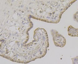 Invitrogen LRP8 Polyclonal Antibody 100 &mu;L; Unconjugated:Antibodies,