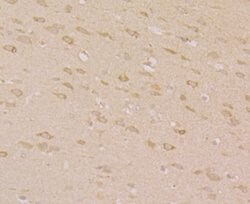 Invitrogen ORAI3 Polyclonal Antibody 100 μL; Unconjugated:Antibodies,