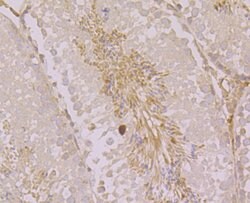 Invitrogen ORAI3 Polyclonal Antibody 100 μL; Unconjugated:Antibodies,
