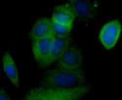 Invitrogen CACNG4 Polyclonal Antibody 100 μL; Unconjugated:Antibodies,