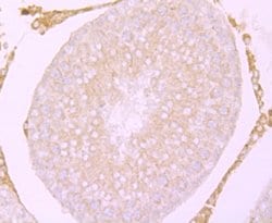 Invitrogen CACNG4 Polyclonal Antibody 100 μL; Unconjugated:Antibodies,