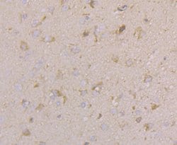 Invitrogen CACNG4 Polyclonal Antibody 100 μL; Unconjugated:Antibodies,