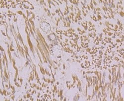 Invitrogen RyR1 Polyclonal Antibody 100 μL; Unconjugated:Antibodies,