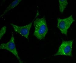 Invitrogen Ryanodine Receptor Polyclonal Antibody 100 &mu;L; Unconjugated:Antibodies,