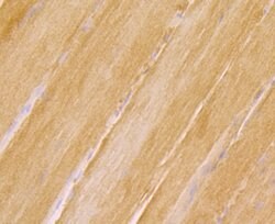 Invitrogen Ryanodine Receptor Polyclonal Antibody 100 &mu;L; Unconjugated:Antibodies,