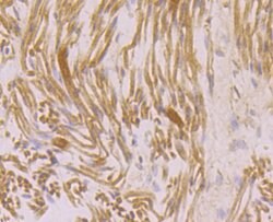 Invitrogen Ryanodine Receptor Polyclonal Antibody 100 &mu;L; Unconjugated:Antibodies,