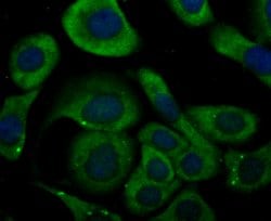 Invitrogen KV1.5 (KCNA5) Polyclonal Antibody 100 &mu;L; Unconjugated:Antibodies,