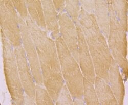 Invitrogen KV1.5 (KCNA5) Polyclonal Antibody 100 &mu;L; Unconjugated:Antibodies,