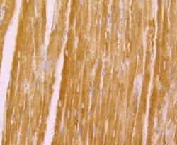 Invitrogen KV1.5 (KCNA5) Polyclonal Antibody 100 &mu;L; Unconjugated:Antibodies,