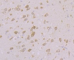Invitrogen CACNB3 Polyclonal Antibody 100 &mu;L | Buy Online | Invitrogen&trade; | Fisher Scientific