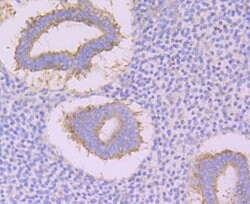 Invitrogen CACNB3 Polyclonal Antibody 100 &mu;L | Buy Online | Invitrogen&trade; | Fisher Scientific