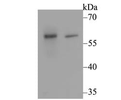 Invitrogen CACNB3 Polyclonal Antibody 100 &mu;L | Buy Online | Invitrogen&trade; | Fisher Scientific