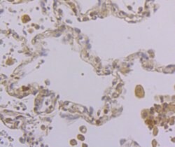 Invitrogen KIF11 Polyclonal Antibody 100 &mu;L; Unconjugated:Antibodies,