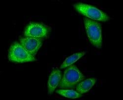 Invitrogen HKDC1 Polyclonal Antibody 100 &mu;L; Unconjugated:Antibodies,