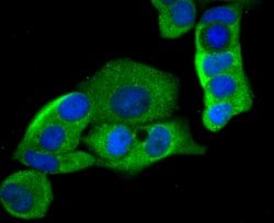 Invitrogen HKDC1 Polyclonal Antibody 100 &mu;L; Unconjugated:Antibodies,