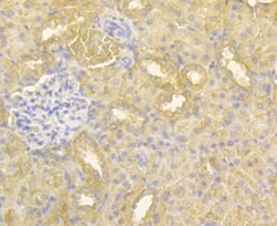 Invitrogen HKDC1 Polyclonal Antibody 100 &mu;L; Unconjugated:Antibodies,