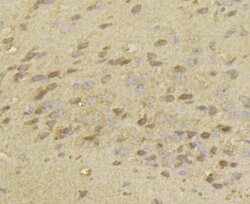 Invitrogen HKDC1 Polyclonal Antibody 100 &mu;L; Unconjugated:Antibodies,