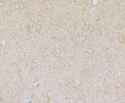 Thermo Scientific ASIC1 Polyclonal Antibody:Antibodies, Polyclonal