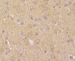 Thermo Scientific ASIC1 Polyclonal Antibody:Antibodies, Polyclonal