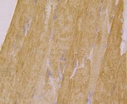 Invitrogen ATP2A1 Polyclonal Antibody 100 &mu;L; Unconjugated:Antibodies,