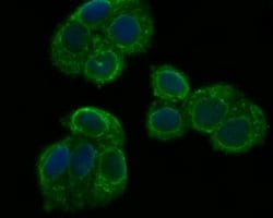 Invitrogen PHF8 Polyclonal Antibody 100 μL; Unconjugated:Antibodies,