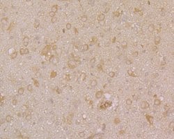 Invitrogen PHF8 Polyclonal Antibody 100 μL; Unconjugated:Antibodies,