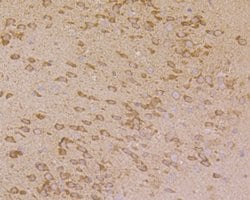 Invitrogen PHF8 Polyclonal Antibody 100 μL; Unconjugated:Antibodies,