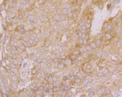 Invitrogen PHF8 Polyclonal Antibody 100 μL; Unconjugated:Antibodies,