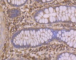 Invitrogen PHF8 Polyclonal Antibody 100 μL; Unconjugated:Antibodies,