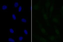 Invitrogen APR3 Polyclonal Antibody 100 &mu;L; Unconjugated:Antibodies,