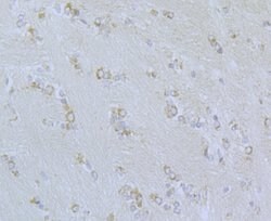 Invitrogen CaV2.3 Polyclonal Antibody 100 &mu;L; Unconjugated:Antibodies,