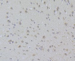 Invitrogen CaV2.3 Polyclonal Antibody 100 &mu;L; Unconjugated:Antibodies,