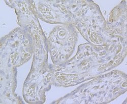 Invitrogen CaV2.3 Polyclonal Antibody 100 &mu;L; Unconjugated:Antibodies,