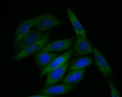 Invitrogen TMEM248 Polyclonal Antibody 100 &mu;L; Unconjugated:Antibodies,