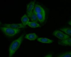 Invitrogen CD40 Polyclonal Antibody 100 &mu;L; Unconjugated:Antibodies,