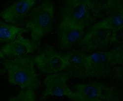 Invitrogen CD40 Polyclonal Antibody 100 &mu;L; Unconjugated:Antibodies,