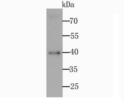 Invitrogen CD40 Polyclonal Antibody 100 &mu;L; Unconjugated:Antibodies,