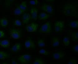 Invitrogen MCU Polyclonal Antibody 100 &mu;L; Unconjugated:Antibodies,