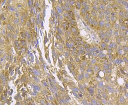 Invitrogen MCU Polyclonal Antibody 100 &mu;L; Unconjugated:Antibodies,