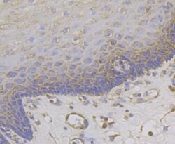 Invitrogen MCU Polyclonal Antibody 100 &mu;L; Unconjugated:Antibodies,