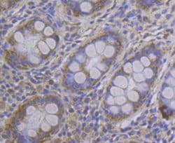 Invitrogen MCU Polyclonal Antibody 100 &mu;L; Unconjugated:Antibodies,