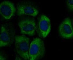 Invitrogen gamma-ENaC Polyclonal Antibody 100 &mu;L; Unconjugated:Antibodies,