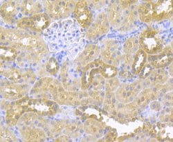 Invitrogen gamma-ENaC Polyclonal Antibody 100 &mu;L; Unconjugated:Antibodies,