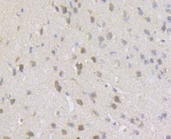 Invitrogen gamma-ENaC Polyclonal Antibody 100 &mu;L; Unconjugated:Antibodies,