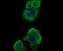 Invitrogen Nephrin Polyclonal Antibody 100 &mu;L; Unconjugated:Antibodies,