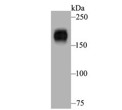 Invitrogen Nephrin Polyclonal Antibody 100 &mu;L; Unconjugated:Antibodies,