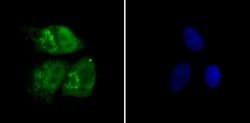 Invitrogen RAD21 Polyclonal Antibody 100 μL; Unconjugated:Antibodies,