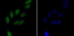 Invitrogen RAD21 Polyclonal Antibody 100 μL; Unconjugated:Antibodies,