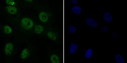 Invitrogen RAD21 Polyclonal Antibody 100 μL; Unconjugated:Antibodies,